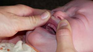 Et ouiiiii, j'ai 2 dents en plus qui poussent !